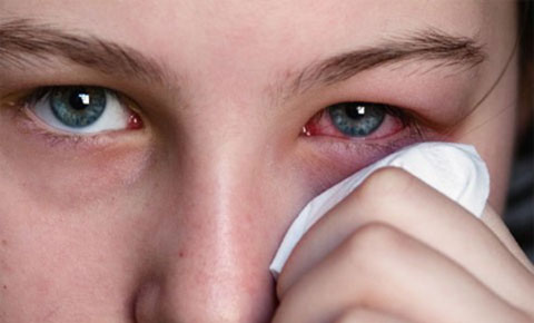 Các triệu chứng cho thấy mắt bị bệnh, triệu chứng về mắt, giải pháp khi bị đau mắt, điều trị các chứng bệnh về mắt, đau cơ mắt
